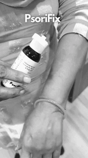psorifix treatment result