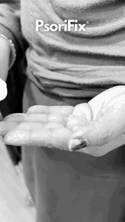 psorifix treatment result