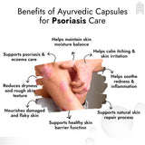Psoriasis & Eczema Treatment Kit (Oil + Cream + Capsules) | 100% Results with No Side Effect