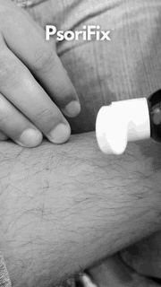 psorifix treatment result